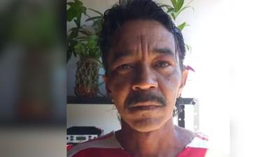 Sobrevivente do acidente com Césio 137 morre em Goiânia
