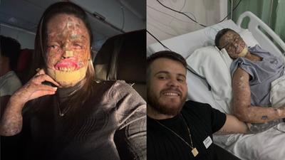 Morre Káh Felipe, influencer com doença rara, aos 31 anos