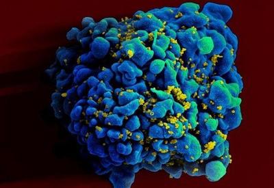 HIV: dois casos de cura do vírus são anunciados