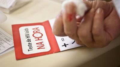 HIV cai 42,9% no mundo, mas metas da ONU seguem longe