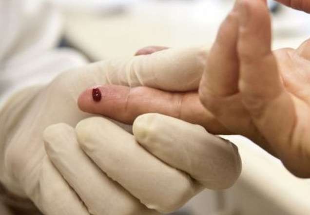 Imagem da noticia Brasileiro passa a testar negativo para HIV após tratamento experimental