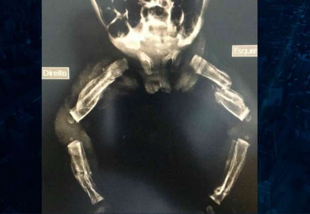 Imagem da noticia Casal é preso após espancar filha de apenas seis meses