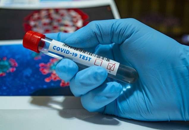 Imagem da noticia Coronavírus: Brasil ultrapassa 13 mil mortes confirmadas
