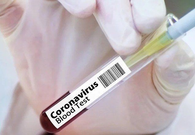 Imagem da noticia Covid-19: UE fecha acordo para comprar 225 milhões de vacinas