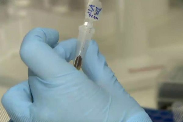 Imagem da noticia Novo exame de sangue promete revolucionar tratamento de câncer