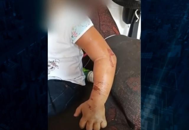 Imagem da noticia Mãe e madrasta são presas suspeitas de espancar criança de 4 anos
