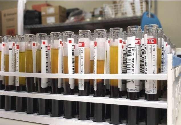 Cientistas estudam se sangue de recuperados previne Covid-19 Cientistas estudam se sangue de recuperados previne Covid-19