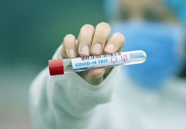 Covid-19: Brasil registra 52.383 novos casos e mais 1.212 mortes Covid-19: Brasil registra 52.383 novos casos e mais 1.212 mortes