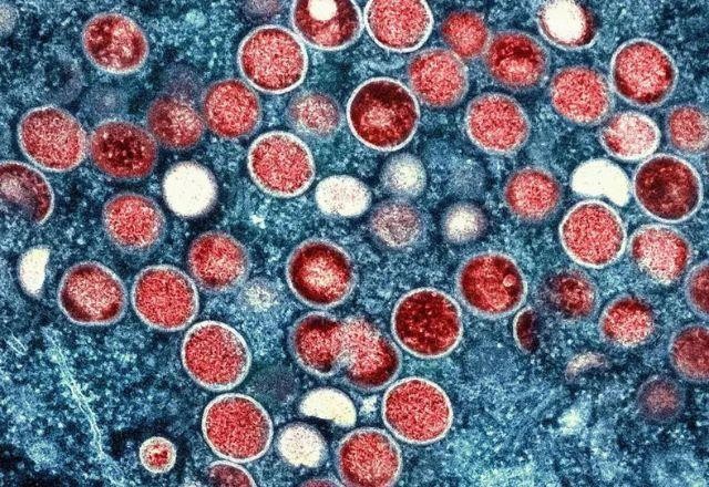Imagem da noticia Número de casos de varíola dos macacos chega a 6,8 mil no Brasil