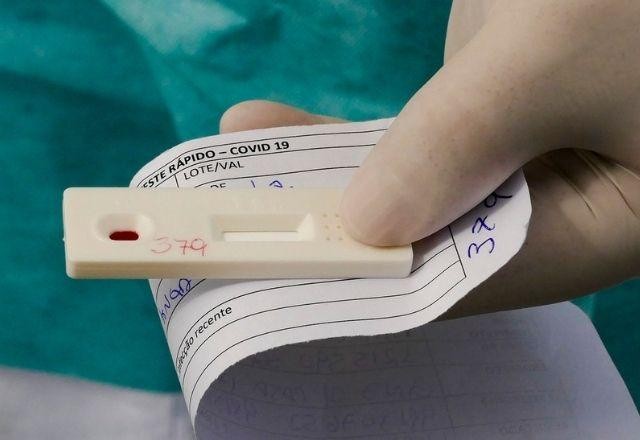 Imagem da noticia Positividade para covid no Brasil sobe de 29% para 35% em uma semana