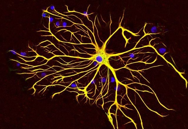 Imagem da noticia Proteger o cérebro do Alzheimer? Estudo brasileiro traz nova aposta contra a doença; entenda