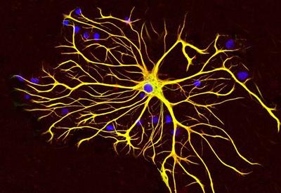 Proteger o cérebro do Alzheimer? Estudo brasileiro traz nova aposta contra a doença; entenda Proteger o cérebro do Alzheimer? Estudo brasileiro traz nova aposta contra a doença; entenda