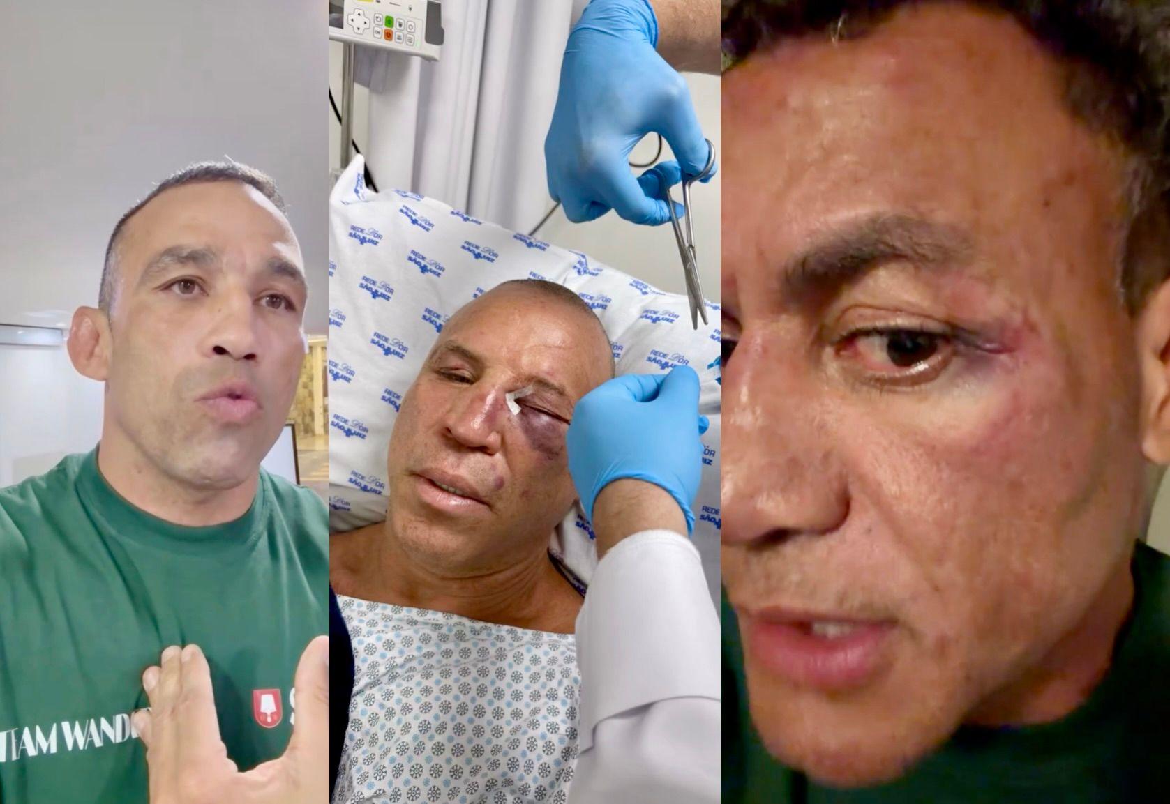 Wanderlei Silva, Popó e Werdum: veja versões sobre briga generalizada após luta Wanderlei Silva, Popó e Werdum: veja versões sobre briga generalizada após luta
