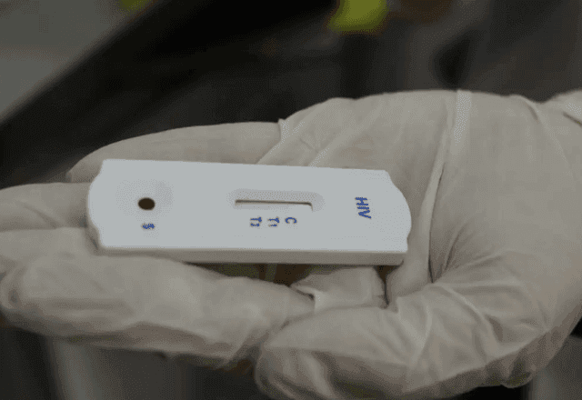 Nova variante do HIV é detectada em três estados brasileiros, diz estudo Nova variante do HIV é detectada em três estados brasileiros, diz estudo