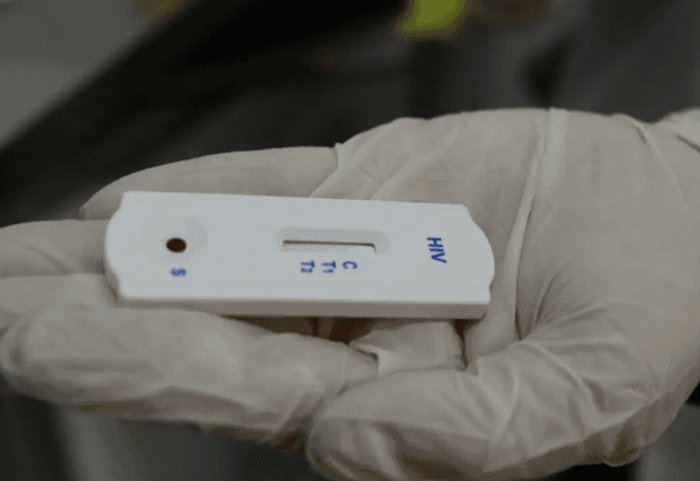 Imagem da noticia Anvisa diz priorizar análise de medicamento para prevenção do HIV aprovado nos EUA e Europa