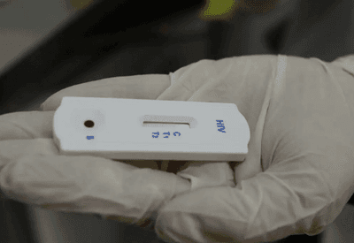 Laboratório investigado no RJ por transplantes irregulares operava em 11 estados Laboratório investigado no RJ por transplantes irregulares operava em 11 estados