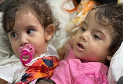 Após 19 horas, hospital conclui cirurgia de separação de gêmeas siamesas Após 19 horas, hospital conclui cirurgia de separação de gêmeas siamesas