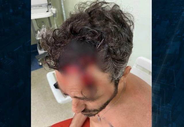 Imagem da noticia Agressão a ator: polícia trabalha com três linhas de investigação