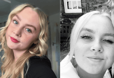 "Tenho que colar meus olhos abertos": jovem de 22 anos é diagnosticada com blefaroespasmo; entenda "Tenho que colar meus olhos abertos": jovem de 22 anos é diagnosticada com blefaroespasmo; entenda