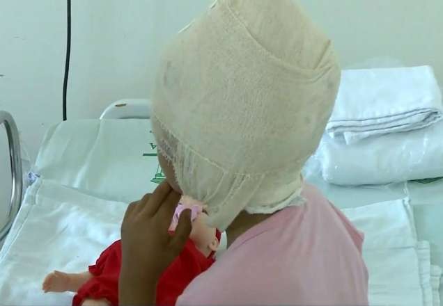 Imagem da noticia Motor de barco suga cabelo de menina de 7 anos no Pará