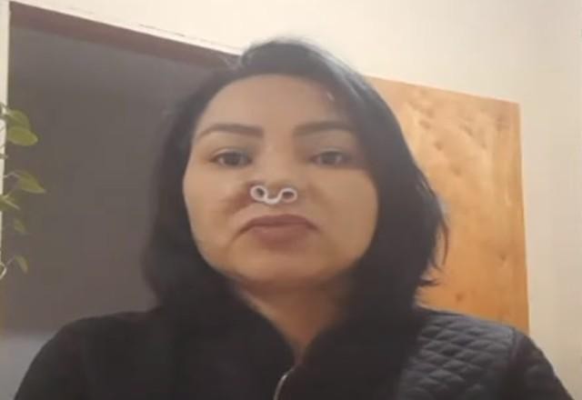Imagem da noticia Mulher faz cirurgia plástica com dentista e tem nariz deformado