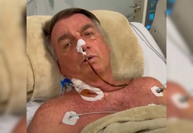 Imagem da noticia Laparotomia exploradora: entenda a cirurgia que libera e reconstrói parede abdominal de Bolsonaro