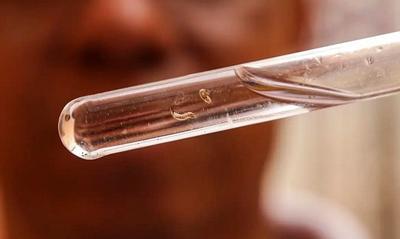 Casos de dengue ultrapassam 6,5 milhões no Brasil  Casos de dengue ultrapassam 6,5 milhões no Brasil