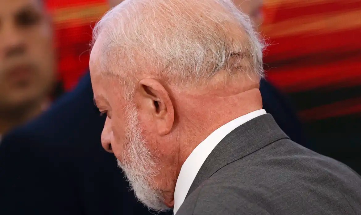Imagem da noticia Lula retira pontos de corte na cabeça após queda em casa